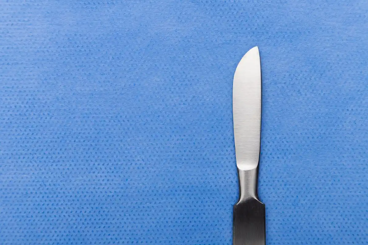 dishwasher knife wrong position closeup damage