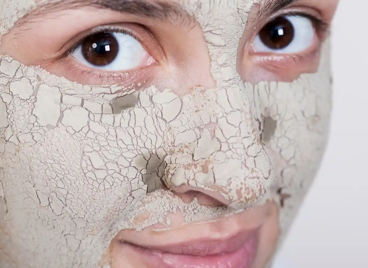 skin chemical peel gone wrong