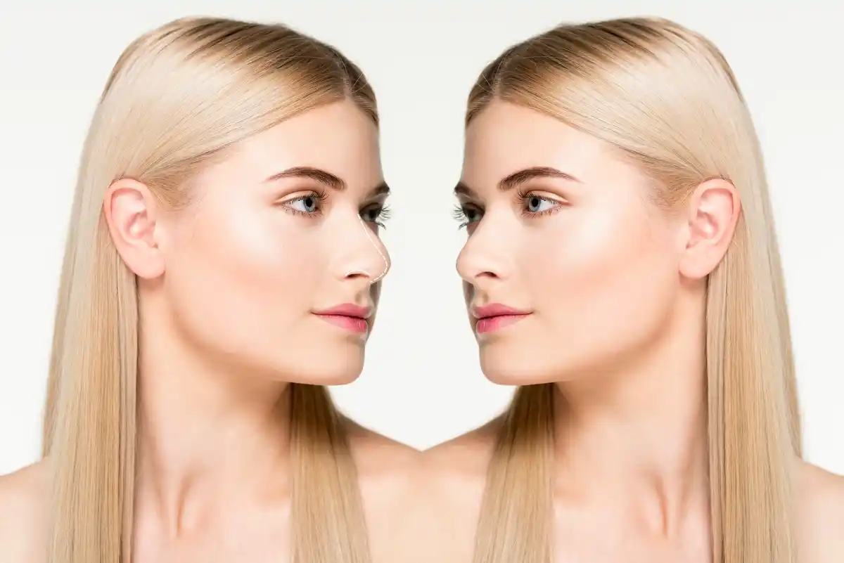 before after natural vs contoured makeup Czech woman