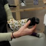 Měkká protetika jako řešení globálního zdravotnického problému